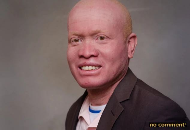 Soja Ramiandrisoa Fulgence « Les albinos...